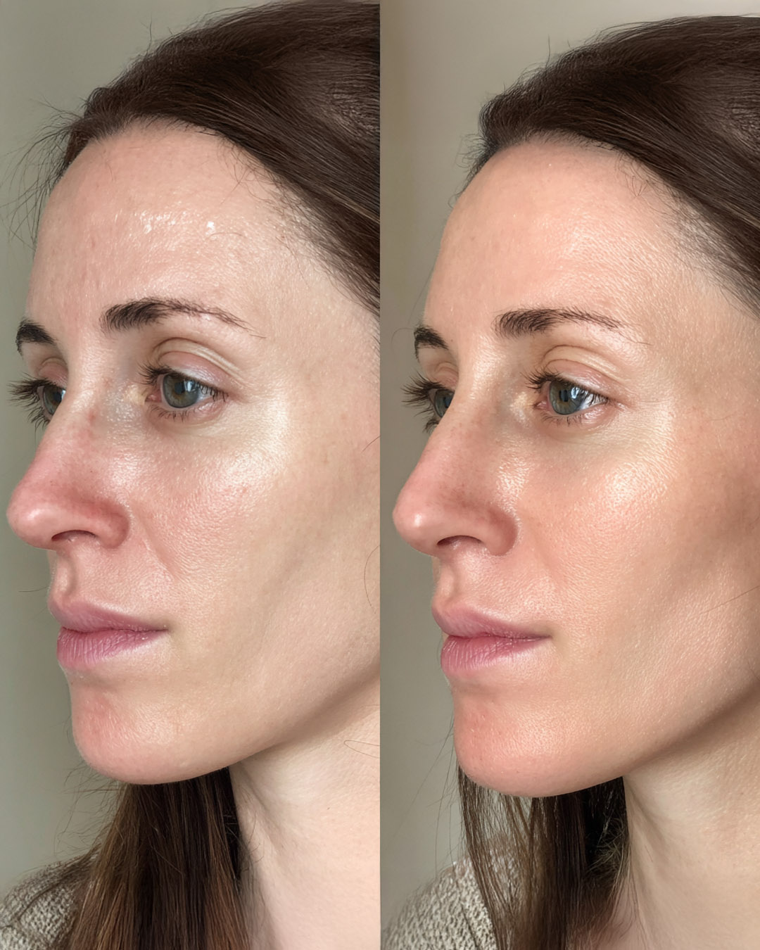 Before and after image showing the effects of Lovebee's serum